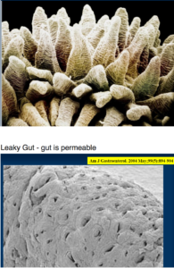Healthy villi
